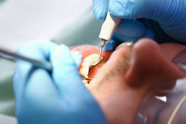 Best Urgent Tooth Repair  in Penbrook, PA