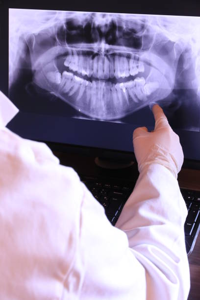 Best Knocked-Out Tooth Emergency  in Penbrook, PA
